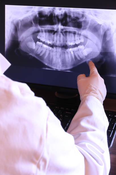 Best Emergency Treatment for Dental Infections or Abscesses in Lake Cassidy, WA