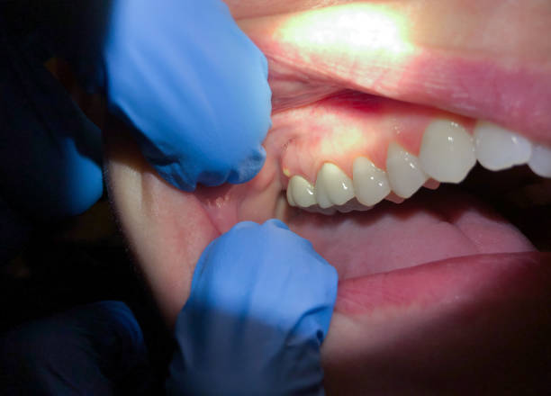 Best Cosmetic Emergency Dentistry in Lake Cassidy, WA